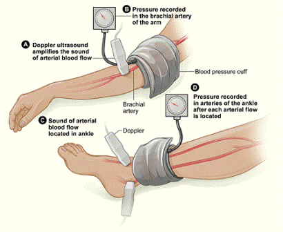 The 
Saving Legs Project